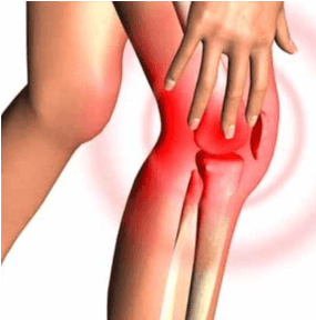 Kök Hücre Tedavisi eklem kireçlenmesi olan hastalarda eklem kıkırdağını onarıp, iyileştirir