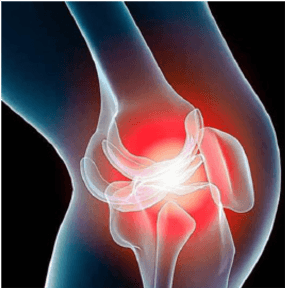 Kök hücre ile eklem tedavisi kıkırdak yenilenmesi ve kıkırdak tamiri sağlayarak eklem ağrılarını giderir