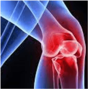 Kıkırdak Hasarı ve Yaralanmasında Kök Hücre Tedavisi