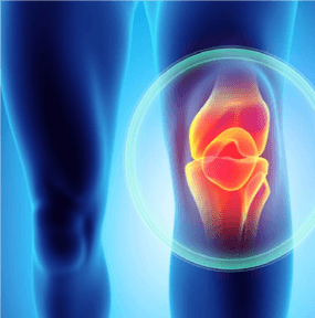 Diz Kök Hücre Tedavisi – Ameliyatsız Diz Kireçlenmesi Tedavisi