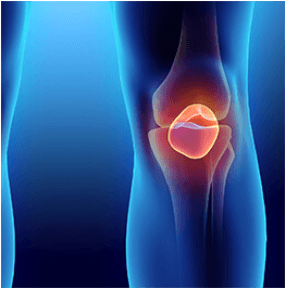 Menisküs Kök Hücre Tedavisi