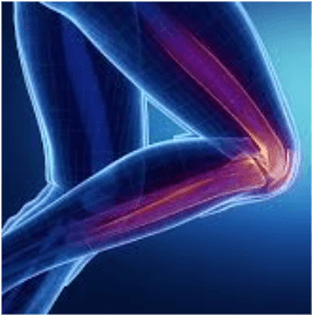 Menisküs Nedir? Kök Hücre ile Menisküs Tedavisi Nasıl Yapılır?