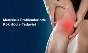 menisküs yırtığı ameliyatsız tedavi