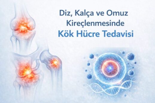 Diz, Kalça ve Omuz Eklem Kireçlenmesinde Kök Hücre Tedavisi