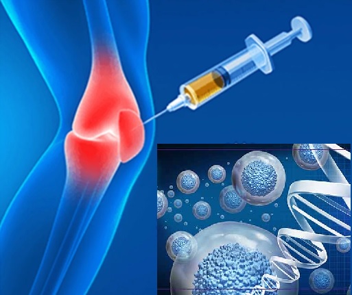 ameliyatsız kireçlenme tedavisi
